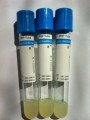 Eprubete PRP - 10 ml - de la 68 lei / buc