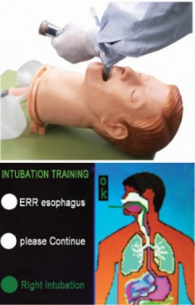 MANECHIN INTUBARE ENDOTRAHEALA, MBJ55+