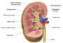 Cancer renal