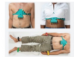 Electrocardiogramele si noul concept de aplicare a electrozilor