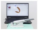 DentArbre - cabinet stomatologic Bucuresti dotat cu scanner intra-oral.