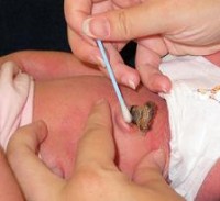 ingrijire cordon ombilical nou-nascut
