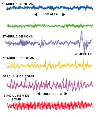 Stadii somn
