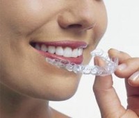 invisalign