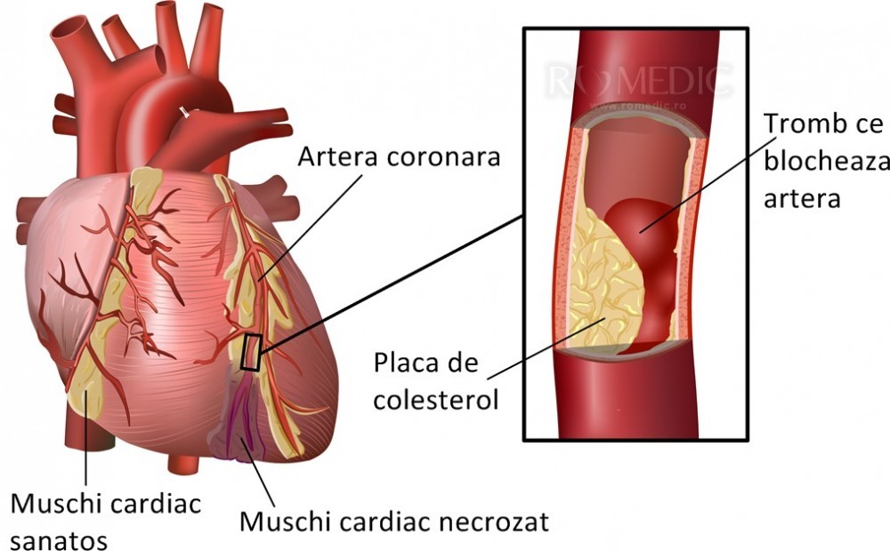Inima Cordul Anatomie Si Fiziologie