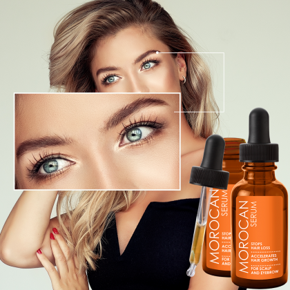 Căderea părului în exces, o problemă ce poate fi rezolvată