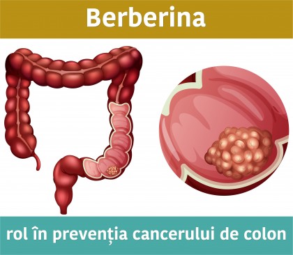 Berberina - rol în prevenirea cancerului de colon