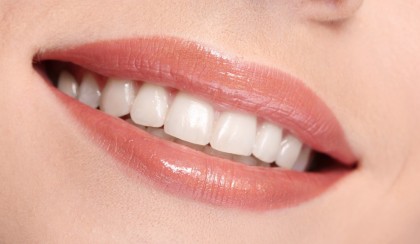 Dinți albi perfecți