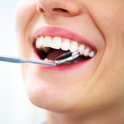 Albirea dentară la cabinetul stomatologic