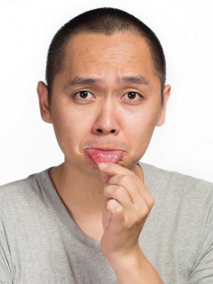 De ce apar aftele bucale?