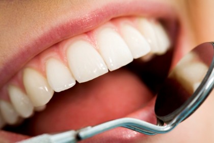 Protezele dentare - etape de realizare și recomandări