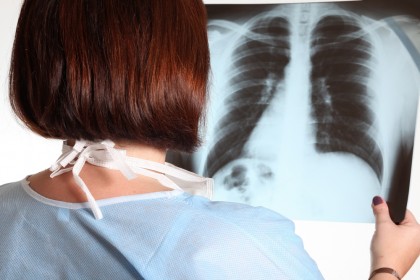 Restabilirea sintezei lipidelor ar putea reduce fibroza pulmonară