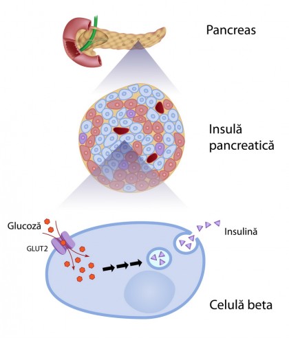 Modificările moleculelor din sânge, posibili markeri noi ai diabetului de tip 1