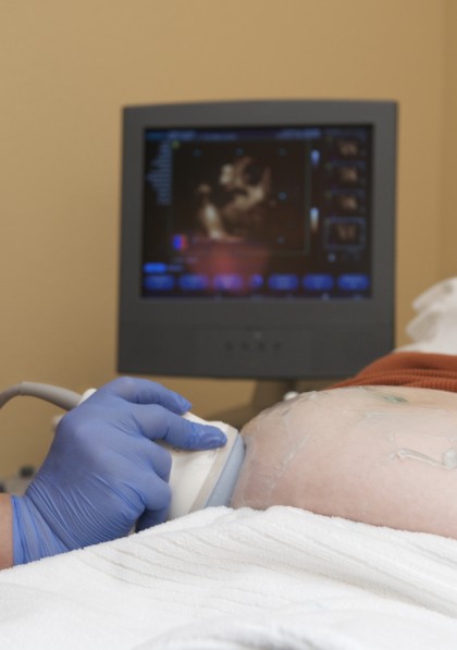 Testele de screening prenatal