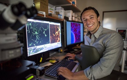 Creierul uman miniatural, folosit pentru testarea tratamentelor sindromului Rett