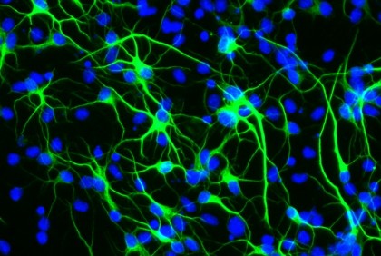 O genă a longevității protejează celulele stem neurale împotriva stresului