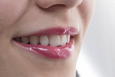 Anomalii dentare ce pot fi corectate ortodontic