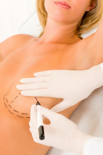 Cum afectează suprafețele implanturilor mamare din silicon sistemul imunitar?