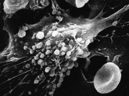 Cum se desfășoară apoptoza (procesul de moarte celulară programată)