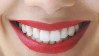Motive pentru care recomand cabinetul stomatologic Dental West din propria experiență