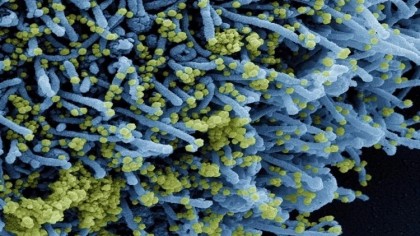 Mai bine de 90% dintre decesele asociate COVID-19 ar putea fi evitate, prin vaccinarea cu o doză suplimentară