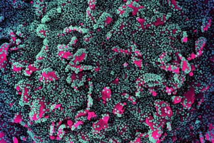 Actualizarea vaccinurilor împotriva COVID-19 ar putea spori eficacitatea lor și durata răspunsului imun