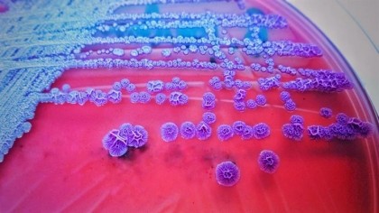 Rezistența antimicrobiană, una dintre principalele cauze de deces la nivel global