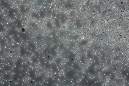 Schimbările de temperatură pot influența rata de transmisie a bolilor infecțioase