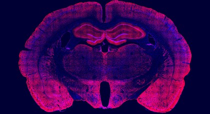 Un studiu recent poate ajuta la îmbunătățirea tratamentului alcoolismului