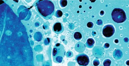 Rolul inflamației și a stresului oxidativ în dezvoltarea cancerului, conform cercetătorilor