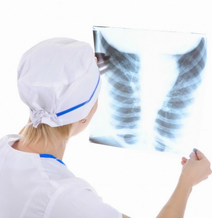 Expunerea prelungită la nivele scăzute de radon, o cauză principală de apariție a cancerului pulmonar