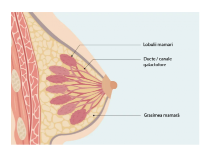Injecțiile intraductale pentru cancerul de sân ar putea elimina toate semnele de boală