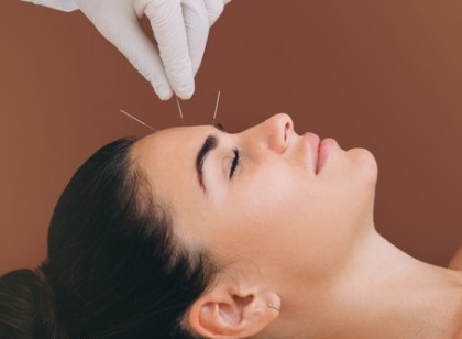 Acupunctura poate ajuta persoanele care suferă cefalee cronică tensională