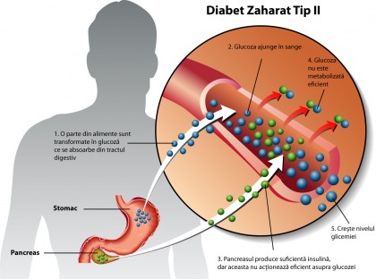Rezistența la insulină și îmbătrânirea avansată a celulelor, asociate sărăciei în copilărie