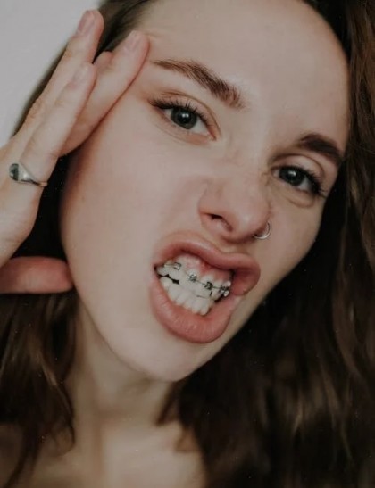 Mușcătura strâmbă