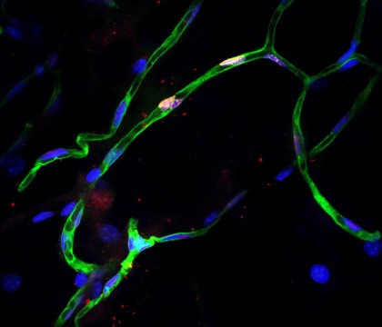 Obezitatea afectează diferit sănătatea bărbaților și a femeilor