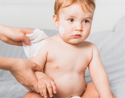 Iritațiile pielii la copii - tipuri, cauze și tratament