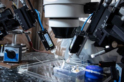 Un hormon esențial pentru menținerea sănătății femeilor, implicat în apariția unei forme de aritmii ereditare