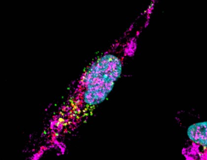 Cercetătorii ar putea folosi eritrocitele pentru a trata ateroscleroza și alte boli