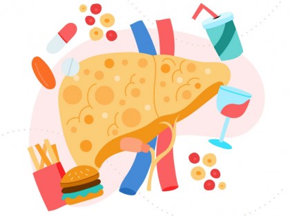 Rolul sindromului metabolic în fibroza hepatică