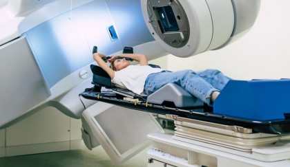 Efecte secundare până acum necunoscute ale radioterapiei pelvine