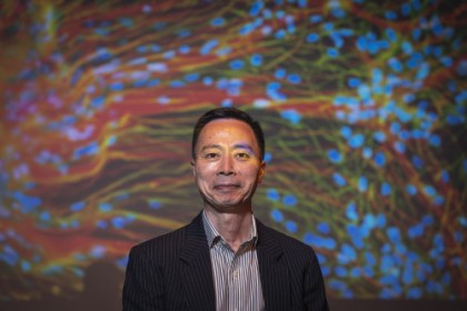 Cercetătorii au realizat țesut cerebral uman funcțional tridimensional