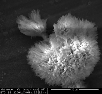 O nouă „armă” împotriva demenței: SEMORE