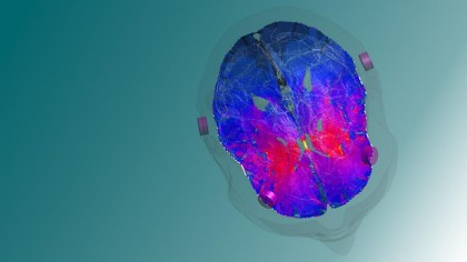 Stimularea cerebrală profundă neinvazivă: o potențială terapie pentru dependență, depresie și TOC