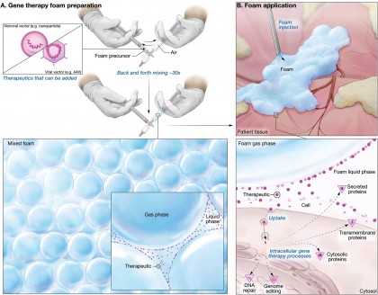 Tehnologia spumei lichide revoluționează terapia genică