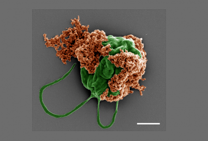 Microroboți biohibrizi pentru inhibarea progresiei metastazelor pulmonare