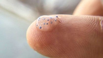 Influența micro- și nanoplasticelor asupra inflamației și mecanismelor de boală