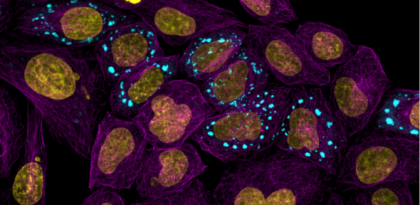 Cercetătorii descoperă cum se comportă proteinele în interiorul celulelor folosind inteligența artificială