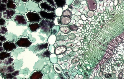 Sindromul de depleție a ADN-ului mitocondrial