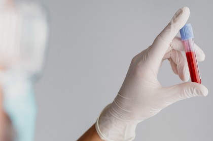 Stabilitatea hemoleucogramei și îngrijirea personalizată